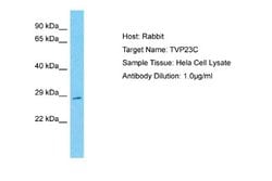 FAM18B2 Rabbit anti-Human, Polyclonal, Novus Biologicals 0.1 mL | Buy Online | Novus Biologicals | Fisher Scientific